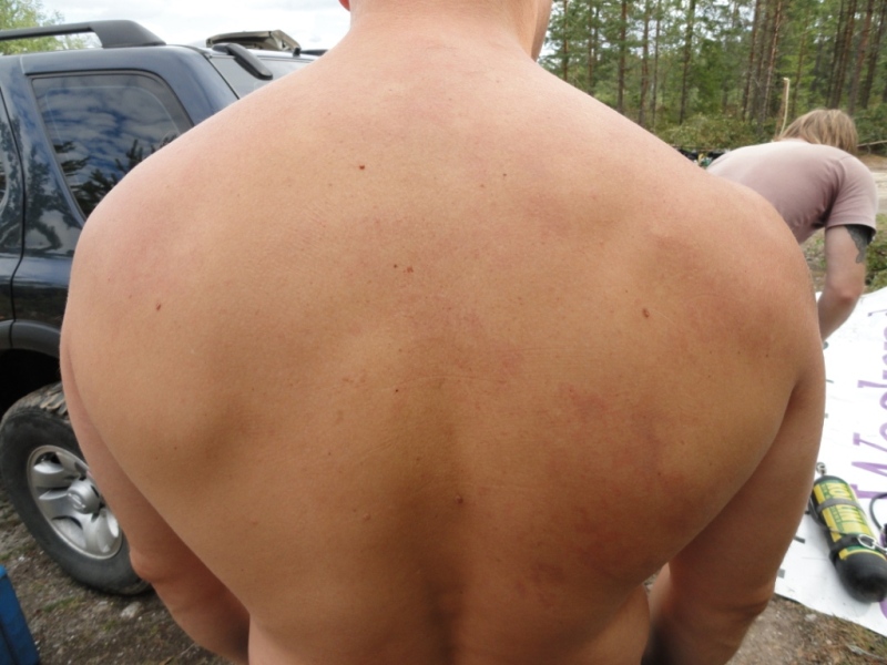 мраморная кожа